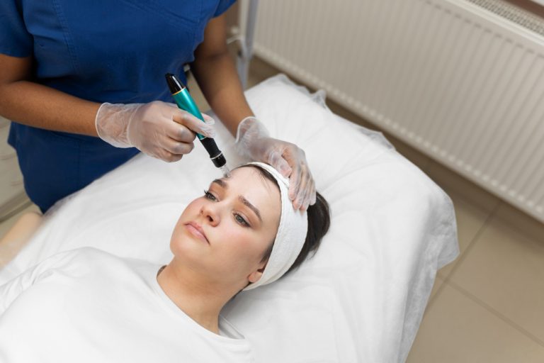 Microneedling